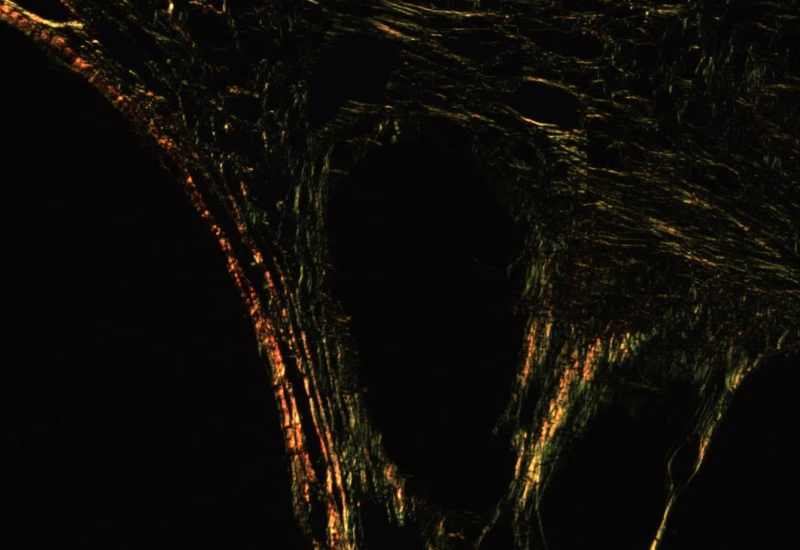 Dynamic Content Image